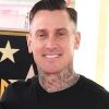 Carey Hart