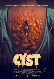 show Cyst