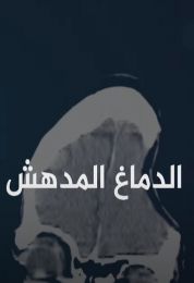الدماغ المدهش