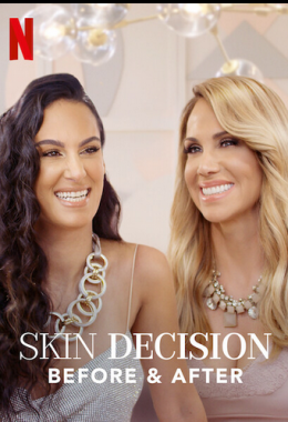Skin Decision: Before and After الموسم الاول